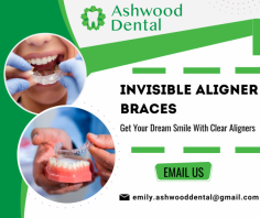 Clear Aligners for Perfect Smile

Our invisible aligners discreetly straighten teeth, offering a comfortable alternative to braces. We provide customized solutions for a confident smile transformation. For more information, mail us at emily.ashwooddental@gmail.com.