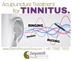 Acupuncture Treatment in Chennai - Jayanth acupuncture provides best acupuncture treatment for Tinnitus without medication and without side effects. gives faster recovery too