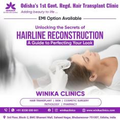 Losing hair can be quite tough for anybody but women seem to be more concerned about them as per surveys. Hence when any woman notices any excessive fall of hair for a consistent period of time they often lose their nerves and begin to explore ways for coping with it. Hence, Hair Fall Treatment for Women is becoming really popular.

See more: https://www.winikaclinics.com/hairline-reconstruction