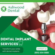 Revolutionizing Smiles with Dental Implants

Our advanced dental implants seamlessly replace missing teeth, offering durable support and a natural look. We prioritize your oral health, ensuring lasting smiles with expert care. For more information, mail us at emily.ashwooddental@gmail.com.