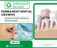 Enduring Smiles with Permanent Crowns

Our permanent crowns provide durable, natural-looking solutions for damaged teeth. We ensure a perfect fit and lasting comfort, enhancing your smile's aesthetics and functionality. For more information, mail us at emily.ashwooddental@gmail.com.