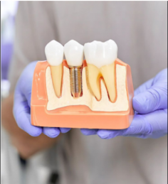 At Miracle Dental Center, we understand how difficult it can be to deal with tooth loss or damage. That’s why we’re proud to offer dental implants in Feasterville that can help improve quality of life. 