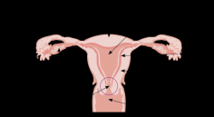 Non-Surgical Solutions for – What Causes an Enlarged Uterus
Are you experiencing discomfort, bloating, or pelvic pain? An enlarged uterus could be the underlying cause. At USA Fibroid Centers, we provide expert guidance on what causes an enlarged uterus and effective, non-surgical solutions to address your symptoms. Conditions like uterine fibroids, adenomyosis, or hormonal imbalances are common culprits that can impact your quality of life. Our specialists offer Uterine Fibroid Embolization (UFE), a minimally invasive treatment that targets fibroids, shrinking them without the need for surgery.
With state-of-the-art technology and compassionate care, our team is dedicated to helping you regain your comfort and well-being. Don't let the symptoms of an enlarged uterus hold you back. Schedule a consultation today and take the first step toward a healthier you.
Visit- https://www.usafibroidcenters.com/uterine-fibroid-symptoms/enlarged-uterus/ 