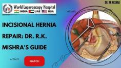 The evolution of minimally invasive surgery has been significantly bolstered by the introduction of laparoscopic incisional hernia repair.
Go to the following this link: https://www.laparoscopyhospital.com/SERV01.HTM