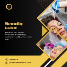 You can feel confident with younger-looking skin with Microneedling Auckland 

Our Anti Ageing Treatment Auckland improves areas with wrinkles and lines and rejuvenates the pore size which in turn makes you feel confident with younger-looking skin. This can be achieved with Microneedling Auckland done in a course of four treatments a week apart.