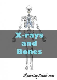 X-rays and Bones Themed #Preschool Reading