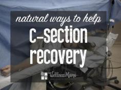 
                    
                        Natural Ways to Help C section Recovery Natural Ways to Help C Section Recovery
                    
                