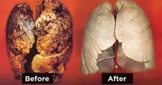 "How To Purify Your Lungs In 72 Hours" Some people have lung problems even though they have never light a cigarette in their life, while other have been smoking for 40 years and their lungs work perfectly fine. All this depends on the person’s organism.