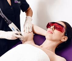 Laser Hair Removal