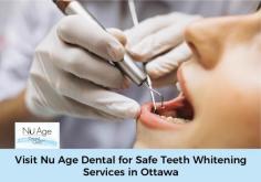 Enhance your smile with Nu Age Dental’s effective teeth whitening services in Ottawa, a top cosmetic procedure. We offer a safe teeth whitening service in a safe environment that can only be performed by trained professionals.