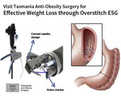 Want to reduce the size of your stomach without any surgery? Get in touch with Tasmania Anti-Obesity Surgery to let us help you achieve your weight-loss goals with overstitch endoscopic sleeve gastroplasty, which is an endoscopic procedure with reduced risks and more rapid recovery. 