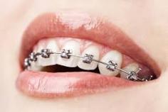 Greenwood Plenty Dental Care provides a best orthodontists in Bundoora, Watsonia and Reservoir offering a wide range of orthodontic treatments to deliver your perfect smile.