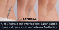 At Cartessa Aesthetics, we specialize in offering effective tattoo removal technology, including  the  Discovery Pico tattoo removal device. This tattoo removal technology can effectively treat all tattoos while reducing the discomfort and recovery time.