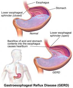 Home - Sripathi Kethu, M.D.

Colon cancer is the 2nd leading cause of cancer death in the US. Both men and women are at risk. For more details, please visit at http://sripathikethumd.com/