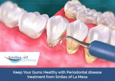 Having bleeding or receding gums? Get in touch with Smiles of La Mesa for periodontal disease treatment. Our skilled dentists do regular check-ups and clean your mouth to detect the gum disease and provide the appropriate treatment. 