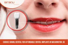 Reclaim your beautiful smile with quality dental implants in Washington DC from Siranli Dental. Our dental implants can help you to restore the natural look and functionality of your teeth. Get in touch today!