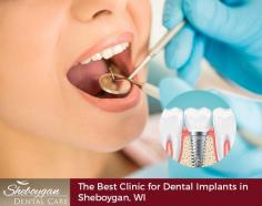 Sheboygan Dental Care is one of the best dental clinics to get quality dental implants in Sheboygan, WI. We specialize in creating custom, natural-looking crowns for our patients. Call us to book your appointment. 