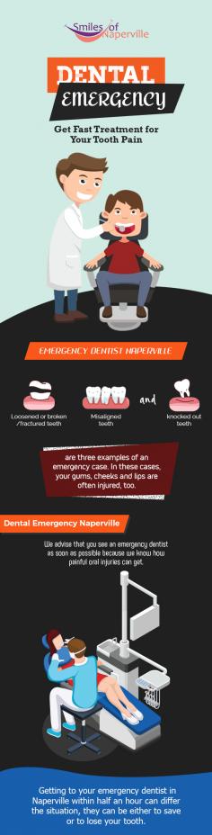 For any kind of dental emergency, get in touch with Smiles of Naperville. Whether you have broken/fractured teeth, misaligned or knocked out teeth, we will treat you right at the time as we know how painful oral injuries are. 