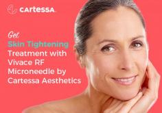 Tighten your skin with Vivace RF Microneedle device provided by Cartessa Aesthetics. This device will increase collagen and further skin tightening with minimal discomfort. For more details, contact us now!