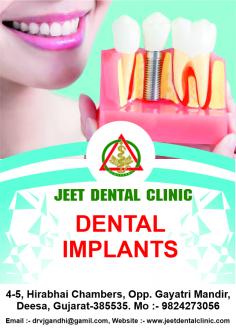 Expert  Dental implants in Deesa

Jeet Dental Clinic is one of the leading dental clinic for dental implants in the Deesa today. Dental implants are used to help replace a tooth and other services.
Call at ￼+91 9824273056 or visit us at jeetdentalclinic.com to book a Appointment with us.