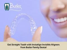 Invisalign invisible aligner by Butler Family Dental is the best option for those who want a straighter smile or improved bite. With advanced 3-D computer-imaging technology, we design custom-made invisaligns to fit your teeth.