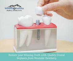 Transform your smile with quality dental implants in El Paso, TX from Westside Dentistry. Whether you are missing a single or multiple teeth, we have a solution to suit your needs. Book an appointment today! 