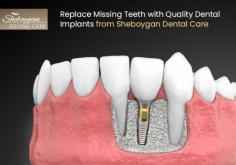 Looking for the quality solution of your missing teeth? Consult with experienced dentists in Sheboygan, WI at Sheboygan Dental Care. Our dental implant looks very natural, no one can know that they are replacements or your original teeth. To know more, visit our website. 