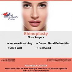 Nose job in Delhi, India is technically called Rhinoplasty and it is a surgical procedure that alters the shape of the nose to either improve its contour or to improve its functionality.
Their clinic is super clean and is following proper hygiene standards. Even in times of COVID -19.
For any kind of enquire about, Nose surgery please complete our contact form https://www.bestrhinoplastyindia.com/contactus.php
Call: +91-9818963662, +91-9958221982
Now New Address: Khasra no 541/542, MG Road, Aya Nagar, Metro Pillar 184, Near the Arjan Garh Metro Station, New Delhi 110047 (India)
#noselift #surgeon #prettynose #nose #selfie #beauty #Asian #ethnicrhinoplasty
