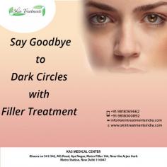 We have had excellent results treating dark circles under the eyes with a combination of topical ointments, peels and carboxytherapy. There is often a slight hollowness called the “tear trough” associated with these circles and this can be improved with fillers. 
To schedule an appointment please call +91-9818300892.
Visit: https://www.skintreatmentsindia.com
Now New Address: Khasra no 541/542, MG Road, Aya Nagar, Metro Pillar 184, Near the Arjan Garh Metro Station, New Delhi 110047 (India)
#Kasmedicalcenter #drajayakashyap #bestcost #skintreatment #darkcircle #undereyedarkcircle #nonsurgical
