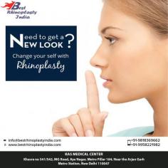 Unhappy with the shape or size of your Nose? Rhinoplasty can correct any flaw & reconstruct the nose to address any deformity or breathing issue.
Contact us anytime with any questions you may have, or to schedule your consultation for rhinoplasty surgery in Delhi, India.
You can call us to schedule a video consultation.
CONTACT US:-
Dr. Ajaya Kashyap
Web: www.bestrhinoplastyindia.com
Now New Address: Khasra no 541/542, MG Road, Aya Nagar, Metro Pillar 184, Near the Arjan Garh Metro Station, New Delhi 110047 (India)
#KasMedicalCenter #Delhi #India #rhinoplasty #nosesurgery #nosereshaping #smallnose #widenose #broadnose #nosejob #plasticsurgery #plasticsurgeon #cosmeticsurgery #cosmeticsurgeon #bestplasticsurgeon #topplasticsurgeon #aesthetician #medspa
