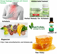 Certain herbs can also aid you to get rid of achalasia naturally. Goldenseal is an important herbal ingredient used in Natural Remedies for Achalasia and many other different kinds of diseases.
