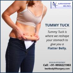 Looking for Best Tumm Tuck Surgery in Delhi? We at Abdominoplasty clinic, provide Tummy tuck surgery at affordable cost/ price in India by top abdominoplasty surgeon - Dr. Ajaya Kashyap at KAS Medical Center. See the before & after photos, procedure videos, FAQ's, patient testimonials etc. Visit Now.
Their clinic is super clean and is following proper hygiene standards. Even in times of COVID -19.
For more info visit https://www.bestbodyliftsurgery.com
#TummyTuck #TummyTuckSurgery #CosmeticSurgery #PlasticSurgeon #DrAjayaKashyap
