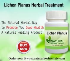 Herbal Treatment for Lichen Planus read the Symptoms and Causes. Lichen Planus is an uncommon disorder of unknown cause that commonly affects middle-aged adults.