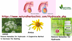 The helpful Natural Remedies for Hydrocele due to injury are conium and arnica. The testicles get inflamed and take on a bluish-red form in cases where arnica will prove the most useful among natural remedies for hydrocele.