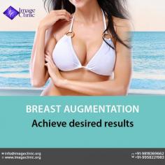 Breast augmentation can increase fullness and projection of your breasts, improve the balance of your figure, enhance your self-image and self- confidence. 
To schedule an appointment please call +91-9958221983.
Visit: https://www.imageclinic.org/breast-augmentation.html
Now New Address: Khasra no 541/542, MG Road, Aya Nagar, Metro Pillar 184, Near the Arjan Garh Metro Station, New Delhi 110047 (India)
#breastsurgery #breastimplant #breastaugmentation #cosmeticsurgery #delhi #india
