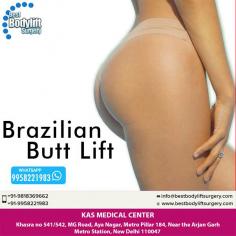 A popular cosmetic procedure, BRAZILIAN BUTT LIFT involves transfer of fat to allow more fullness in the hip area. Contact us for natural and permanent results in terms of roundness and perfect shape. Of course, don’t worry about safety.

KAS MEDICAL CENTER
Khasra no 541/542, MG Road, Aya Nagar, Metro Pillar 184, Near the Arjan Garh Metro Station, New Delhi 110047 (India)
Mobile: +91- 9958221983
Web: www.bestbodyliftsurgery.com

#BBL #BreazilianButtLift #CosmeticSurgery #PlasticSurgeon #Delhi #India
