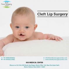 KAS medical Center has experienced surgeon and also have many years of experience in this field. If you are looking for the Cleft Lip Surgery in Delhi then you can undoubtedly go with KAS medical Center.
Website: www.bestfacesurgeryindia.com
Email: info@bestfacesurgeryindia.com
Call +91-9818369662 or +91-9958221982
#cleftlip, #cleftliptrepair, #cleftpalate, #cosmeticsurgery, #plasticsurgeon, #drkashyap, #delhi, #india
