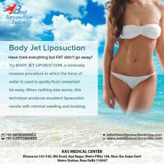 Have tried everything but FAT didn’t go away?
Try BODY JET LIPOSUCTION, a minimally invasive procedure in which the force of water is used to gently flush unwanted fat away. When nothing else works, this technique produces excellent liposuction results with minimal swelling and bruising.
Dr. Ajaya Kashyap over 30 years of experience and qualifications being a Triple American Board certified plastic surgeon allows him to deliver the best cosmetic surgery at affordable cost in Delhi.
Visit: www.bestliposuctionindia.com
Call: +91-9958221983, 9958221982
Now New Address: Khasra no 541/542, MG Road, Aya Nagar, Metro Pillar 184, Near the Arjan Garh Metro Station, New Delhi 110047 (India)
#liposuctionsurgery #abdomen #thigh #arms #neck #buttock #VaserLiposuction #BodyJetLiposuction #plasticsurgeon
