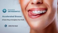 Teeth Straightening at a Faster Rate

We are here to overlook the common concerns of taking orthodontic treatments. Visit our office to enroll in our accelerated braces procedures. Ping us an email today to learn more about our services info@rockwoodsmiles.com.
