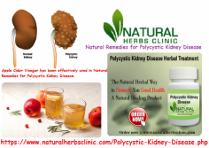 For generations, Apple Cider Vinegar has been effectively used in Natural Remedies for Polycystic Kidney Disease for breaking down kidney stones.
