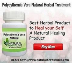 As polycythemia Vera is considered a continual situation without a cure, a lot of treatments are accessible that assist control the situation. Natural Remedies for Polycythemia Vera containing garlic and cayenne help in thinning the blood and stop blood clots.