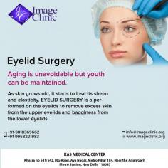 Eyelid Surgery, medically known as Blepharoplasty, helps to rejuvenate the lower and upper eyelids. Sagging eyelids make you appear tired and older than your actual age.
If you have been thinking about getting a best eyelid surgery in Delhi, Blepharoplasty procedure cost in India contact us for an appointment where we can discuss your requirements in more details.

His 27 years of experience and qualifications being a Triple American Board certified plastic surgeon allows him to deliver the best cosmetic surgery at affordable cost in Delhi.
Also, join us on our Instagram page or our website or You can ask for your appointment from our online booking portal as well as by calling us at +91-9818963662, +91-9958221982
Visit: https://www.imageclinic.org/eyelid-surgery.html


#blepharoplasty #eyelidsurgery #lowereyelid #uppereyelid #cosmeticsurgery #plasticsurgeon

