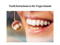 What Are Tooth Extractions?

You and Dr. Jones, Dr. Jones, Dr. Cabbell, Dr. Tingling, Dr. Wensing or Dr. Wall may determine that you need a tooth extraction for any number of reasons. Some teeth are extracted because they are severely decayed; others may have advanced periodontal disease, or have broken in a way that cannot be repaired. Other teeth may need removal because they are poorly positioned in the mouth (such as impacted teeth), or in preparation for orthodontic treatment.

For more info, please visit at https://www.videntalcenter.com/treatments/tooth-extractions