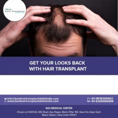 Hair transplants are effective procedures for restoring hair growth following many causes of hair loss. The success rate of hair transplant surgery depends on many factors, including the skill and experience of the surgeon and the thickness of the person’s donor hair.

To schedule an appointment please call +91-9958221983, 9289988888.
Visit: https://www.besthairtransplantdelhiindia.com/
#HairTransplant #HairTransplantSurgeon #FUEHairTransplant #Eyebrow #Eyelash #Beard #Moustaches #CosmeticSurgery #PlasticSurgeon #Drkashyap #Delhi #India

