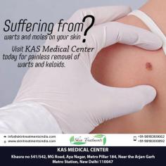 Suffering from warts and moles on your Skin?
visit KAS Medical Center today for painless removal of warts and keloids. Schedule Your Consultation Today! +91-9818300892
Email: info@skintreatmentsindia.com
Address: Khasra no 541/542, MG Road, Aya Nagar, Metro Pillar 184, Near the Arjan Garh Metro Station, New Delhi 110047 (India)
#MoleRemoval #SkinTreatments #Lasers #Warts #Moles #Keloids