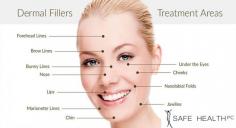 Dermal fillers are small injections of gel, typically made up of hyaluronic acid, that fill in wrinkles and add volume to soft tissue. At Safe Health & Med Spa, Lansing, and Mount Pleasant, our expert cosmetic dermatologists headed by Dr. Fatteh recognize the bothersome wrinkles, lines, and facial creases that can impact your looks.