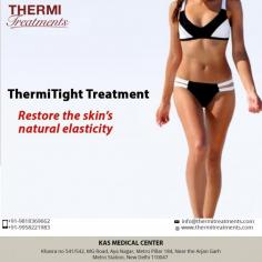 ThermiTight® can help undo the damage done by time, restoring the skin’s natural elasticity and improving the appearance of everything from sagging jowls, to crepey skin on the neck, to loose skin on the stomach, to sagging skin on the back of the arms, and more, all in a single treatment. 
visit: https://www.thermitreatments.com/thermitight.html
Address: Khasra no 541/542, MG Road, Aya Nagar, Metro Pillar 184, Near the Arjan Garh Metro Station, New Delhi 110047 (India)
#thermitight #skintightning #nonsurgical #jowls #doublechin #armlift #facelift #necklift #breastlift #thighlift #kneelift
