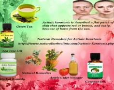 There are many people who have claimed and recorded that when they used different Natural Remedies for Actinic Keratosis, and with a passage of time, it was healed completely.