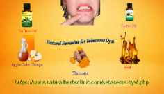 There is a lot of Natural Remedies for Sebaceous Cyst that use turmeric. This healing spice assists to cleanse the blood.