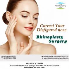 Is breathing trouble making your life difficult? Have you tries several alternative and non-invasive treatment options to get rid of it? Well, now is the time to consider nose surgery for functional or aesthetic problems.

Contact us anytime with any questions you may have, or to schedule your consultation for nose surgery clinic in Delhi, India.

Dr. Ajaya Kashyap
Call: +91-9958221983
Email: info@bestfacesurgeryindia.com
Web: www.bestfacesurgeryindia.com

#nosejob #rhinoplasty #rhinoplastysurgery #rhinoplastysurgeon #rhinoplastycost #cosmeticsurgery #nonsurgical #plasticsurgery #DrAjayaKashyap

